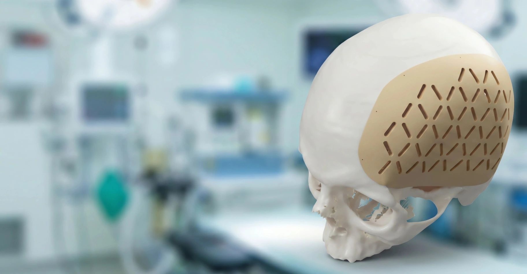 Implante craneal PEEK CRANIUM i3D